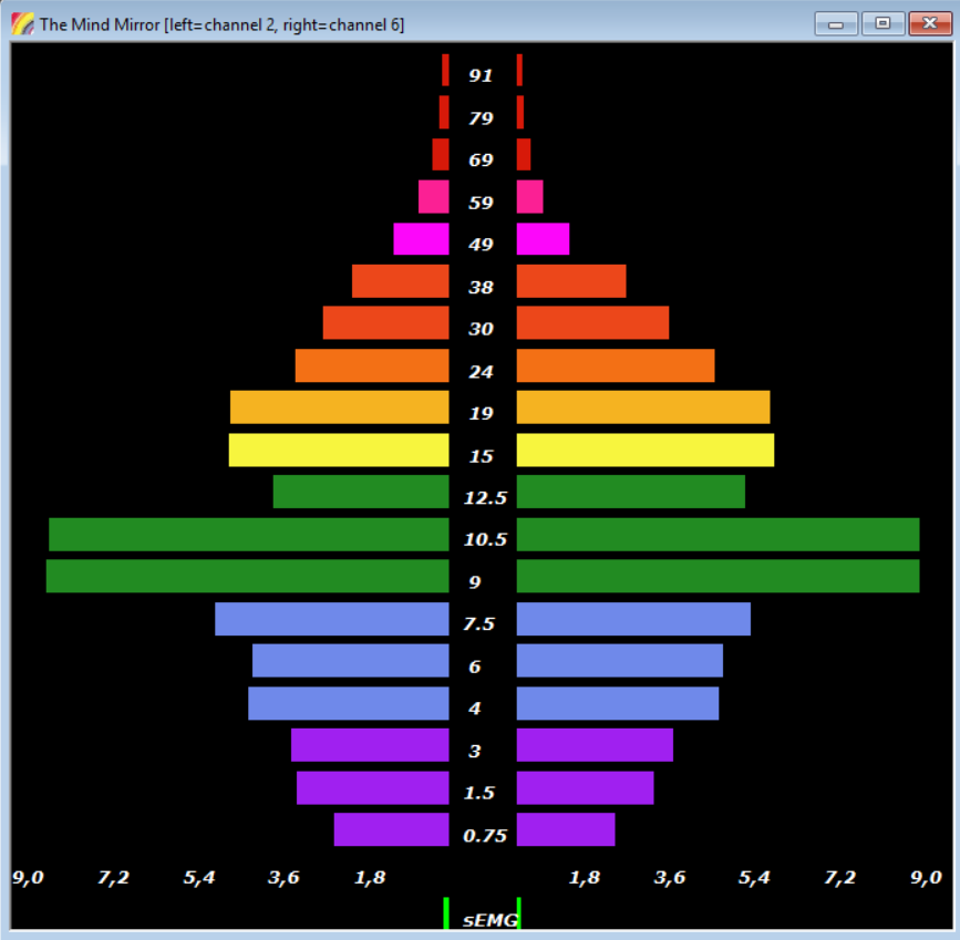 The consciousness brain wave patterns of Stewart Alexander